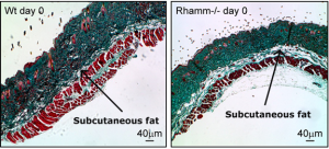 In these images of stained normal mouse wound tissue (left), and mouse tissue with RHAMM blocked, the  green stain shows collagen, the white layers are fat, and the red stain highlights keratinocytes, hair follicles and muscle. The images show that the subcutaneous fat layers in the RHAMM blocked tissue are significantly thicker than those of the normal mouse wound tissue.  