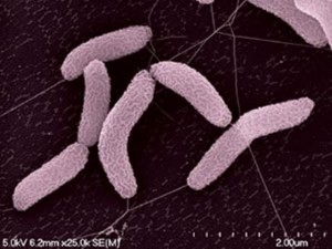 Desulfovibrio vulgaris is an anaerobic sulfate-eating microbe that can also consume toxic and radioactive waste, making it a prime candidate for bioremediation of contaminated environments. (Photo courtesy of Berkeley Lab)