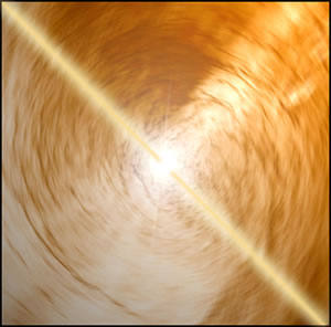 Quark-gluon