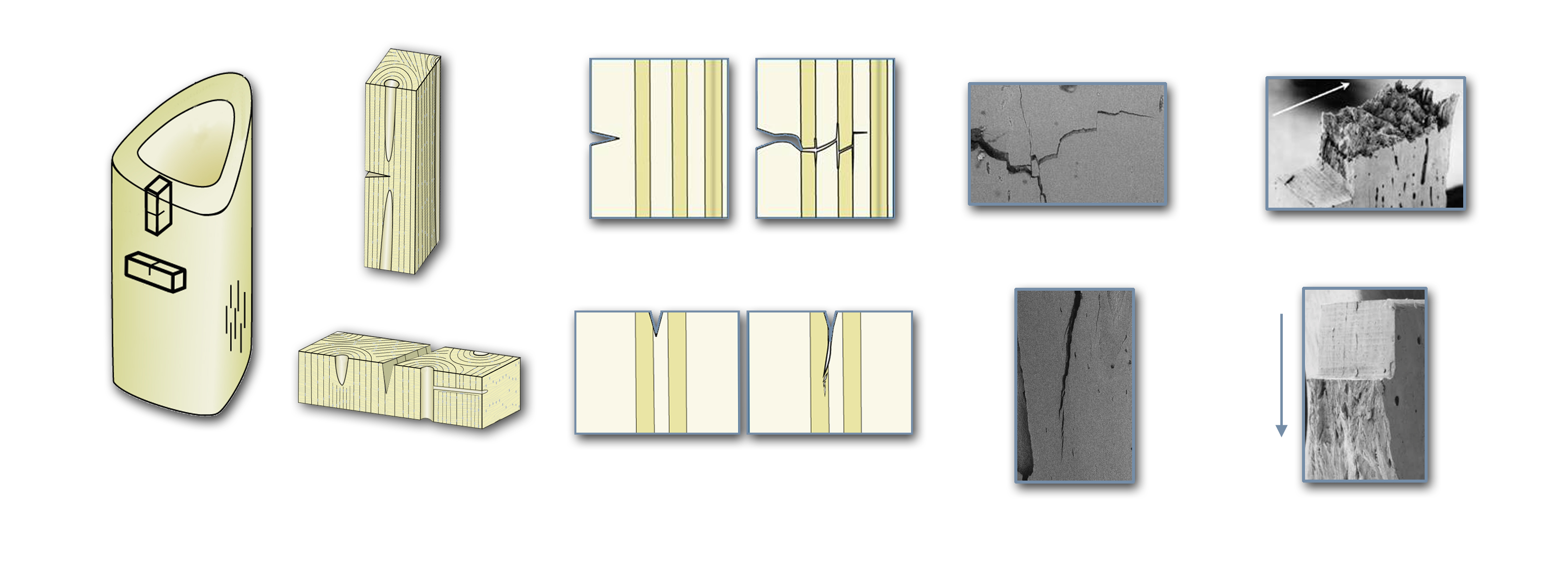 Samples from a human arm bone (humerus) were tested in an environmental scanning electron microscope, revealing the mechanisms which deflect and twist cracks in the transverse orientation (top), leading to five times greater toughness compared to the longitudinal orientation (bottom). For Kurt Koester’s movie of a propagating transverse crack, go here. 