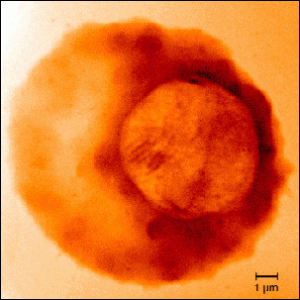 As shown in this x-ray image taken at Berkeley Lab’s Advanced Light Source, the malaria parasite develops inside red blood cells, where it accumulates iron. It is vulnerable to the oxygen-based free radicals released by a powerful but scarce antimalarial drug known as artemisinin.