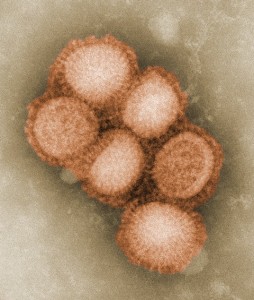 A mutation in the H1N1 influenza A virus - a pair of amino acid variants termed the ‘SR polymorphism’ – was found to enhance replication of the virus in humans. (Image courtesy of NIGMS)