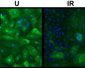 In these images of unirradiated and irradiated breast cells, nuclei have been dyed blue and tumor-suppressing p-16 proteins have been stained with a green fluorescent. The paucity of p-16 in the irradiated cells indicates the presence of a pre-cancerous vHMEC phenotype. (Image from Paul Yaswen)