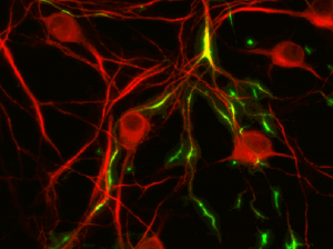 TREK1 potassium ion channels, stained green in these cultured hippocampal neurons, have been linked to the regulation of emotions. (Image from Isacoff group)