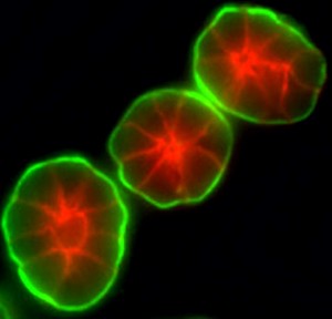 A 3D cell culture assay developed by Mina Bissell and her research group enables breast cells to reproduce actual structural units, an advantage that was essential for understanding the role of laminin in breast cancer development. (Image from Bissell group)