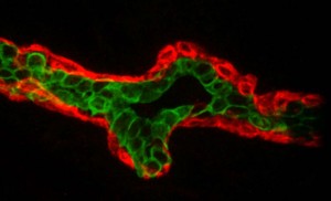 This tissue section from a normal mammary gland has been stained to show myoepithelial cells (red) and luminal epithelial cells (green). (Image from Mark LaBarge)