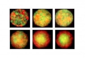 These image show the distribution of cell lineages in human mammary epitheial cells over time in the presence of (top) an anti–E-cadherin agent and (bottom) an anti–P-cadherin agent. LEPs are stained green, and MEPs are stained red. (Image from Mark LaBarge)