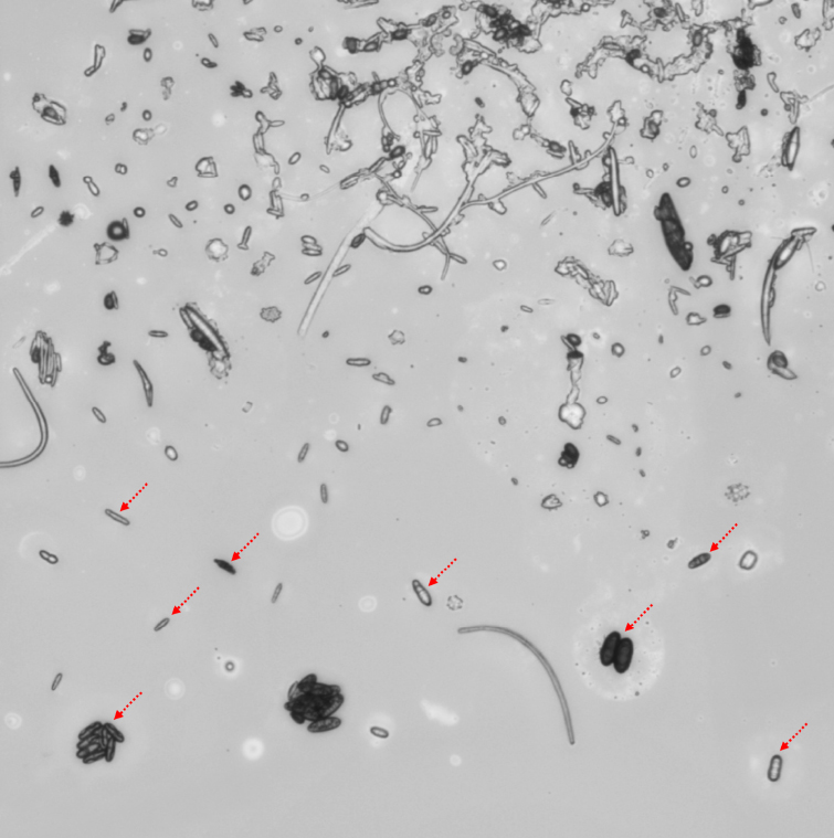Under a light microscope, diverse and abundant fungal spores (red arrows) are visible in a large aerosol particle collected in the Amazon rainforest. (Max Planck Institute for Chemistry)
