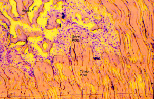 This image, which depicts a tendon-muscle junction in an adolescent chicken (approximately 4 months old), suggests a new way to repair tendons. It shows a growth plate with a large number of tendon cells stained purple. The muscle is at the top left and the tendon is at the bottom and right. The tendon, which is made up of a group of threads called fibrils, is growing so that the tendon length will match the growth of the bones. The image shows that mature tendon has very few cells. Click on the image for larger version. (Credit: Richard Schwarz)