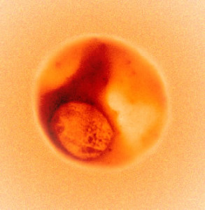 X-ray image taken at Berkeley Lab's Advanced Light Source shows malaria parasite inside red blood cell.