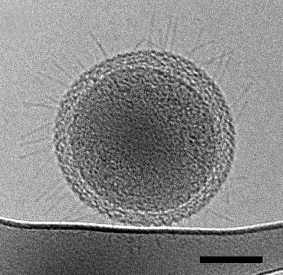 A lifeline to other cells? Cryo-transmission electron microscopy captured numerous hairlike appendages radiating from the surface of this ultra-small bacteria cell. The scientists theorize the pili-like structures enable the cell to connect with other microbes and obtain life-giving resources. The scale bar is 100 nanometers. (Credit: Berkeley Lab)