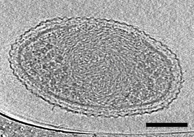 This cryo-electron tomography image reveals the internal structure of an ultra-small bacteria cell like never before. The cell has a very dense interior compartment and a complex cell wall. The darker spots at each end of the cell are most likely ribosomes. The image was obtained from a 3-D reconstruction. The scale bar is 100 nanometers. (Credit: Berkeley Lab)
