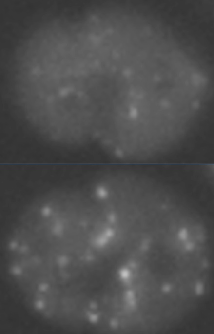 The top image shows a cell before radiation exposure, the bottom image shows the same cell after exposure to 1 Gy of radiation. (Credit: Berkeley Lab)