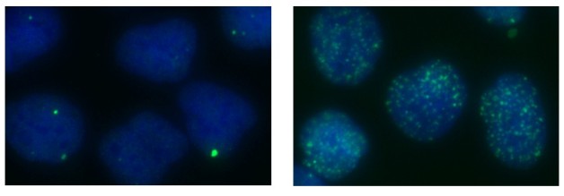 The scientists found that genome instability increases in cells as XPG levels decrease. The green spots mark locations of DNA double-strand breaks. The left image shows normal human cells and the right image shows XPG-depleted cells. (Credit: Berkeley Lab)