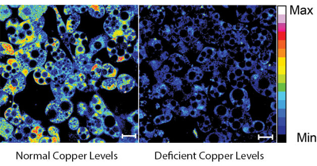 A fluorescent probe creates a heat map of copper in white fat cells. Yellow and red regions show higher levels of copper. The left panel shows normal levels of copper from cells of control mice, while the panel on the right shows deficient levels of copper. (Credit: Lakshmi Krishnamoorthy and Joseph Cotruvo Jr./UC Berkeley)