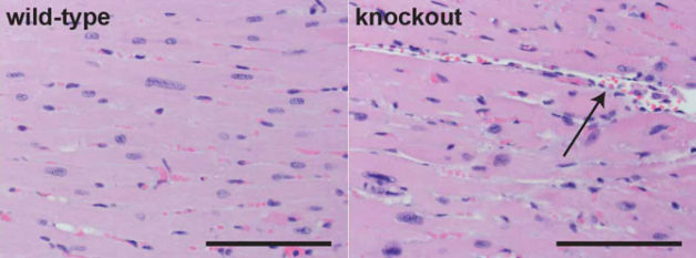 Heart tissue from a normal (wild-type) mouse, with cells stained pink and nuclei in blue, is shown on the left. Hearts from mice missing an important heart enhancer (knockout) exhibit disorganized cell growth, including large spaces between cells (arrow), as shown on the right. (Credit: UC Davis Comparative Pathology Laboratory)