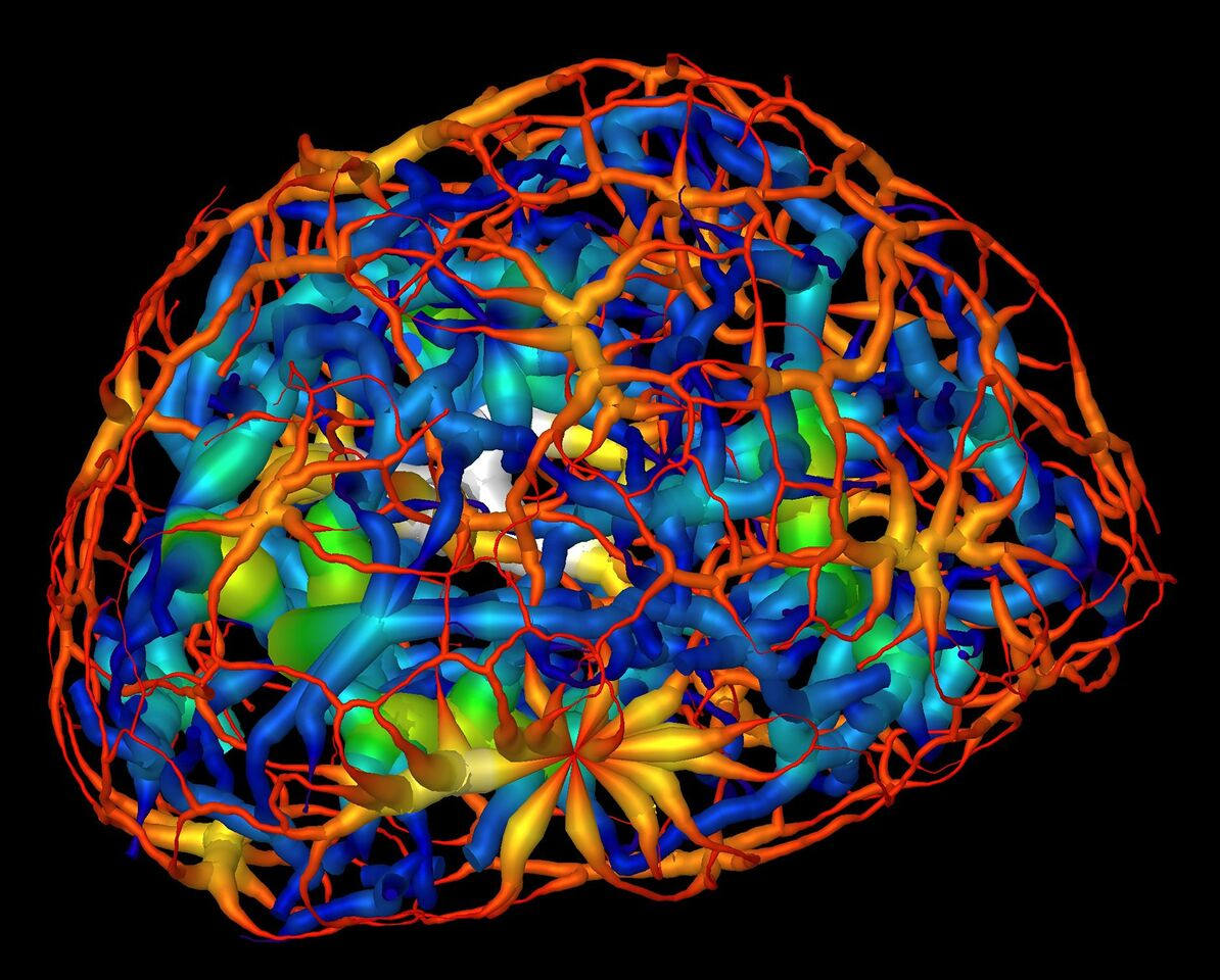 Image - This image shows the skeletonized structure of heterochromatin (red represents a thin region while white represents a thick region), a tightly packed form of DNA, surrounding another form of DNA-carrying material known as euchromatin (dark blue represents a thin region and yellow represent the thickest) in a mouse’s mature nerve cell. (Credit: Berkeley Lab, UCSF)
