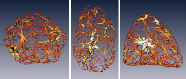 Image - These renderings show a tightly packed form of DNA called heterochromatin, as it exists in a mouse cell’s nucleus, at different stages of cell development: a multipotent stem cell (left), a neuronal progenitor (middle), and a mature nerve cell (right). (Credit: Berkeley Lab, UCSF)