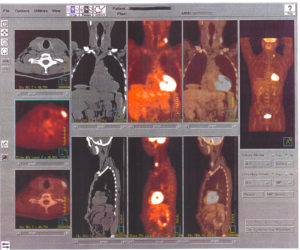 Image - These images, produced by a PET scanner, show internal views of the human body. (Credit: Wikimedia Commons)