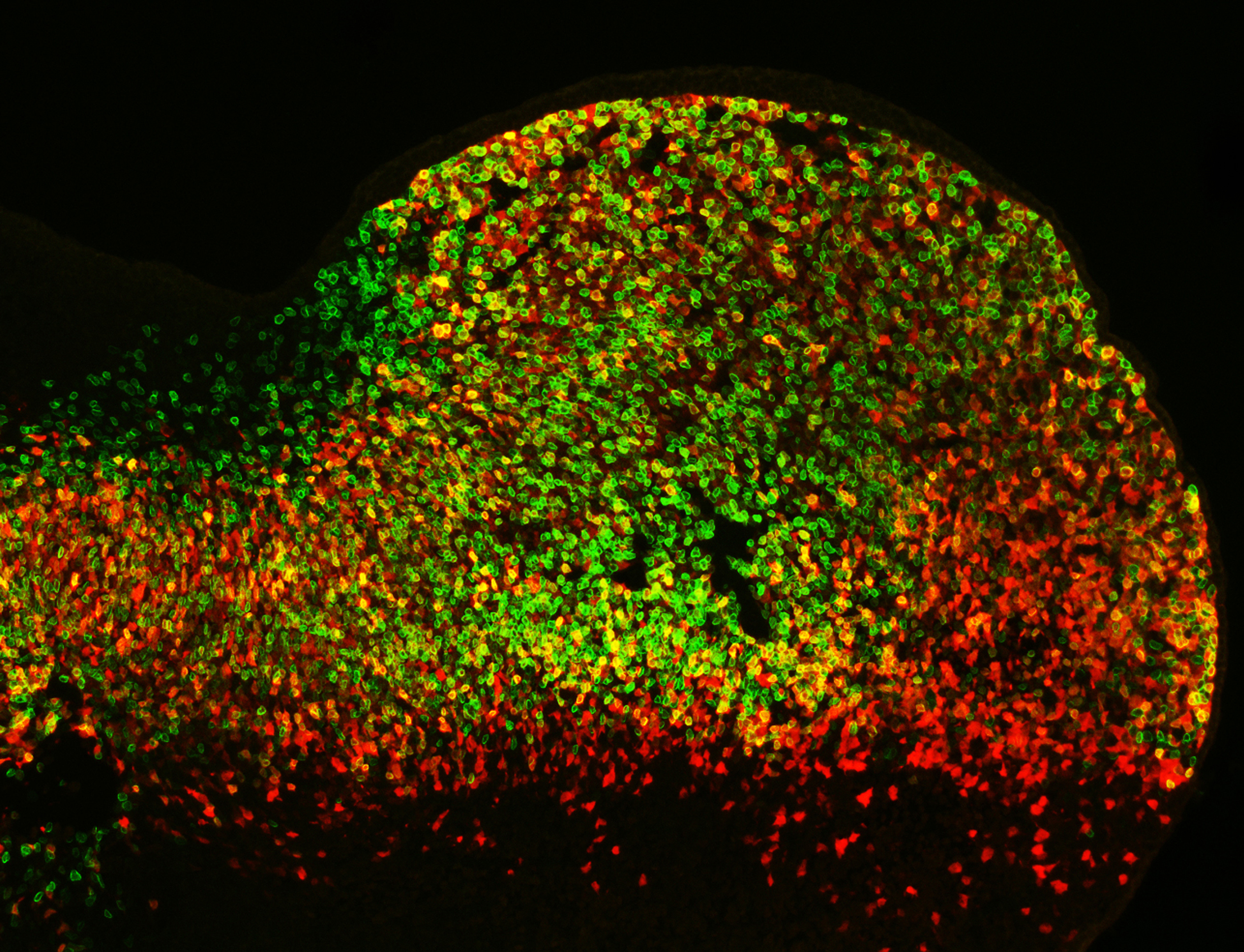 Cell activity patterns of two gene enhancers (red and green cells). Cells in which both enhancers are active appear yellow. (Credit: Marco Osterwalder).