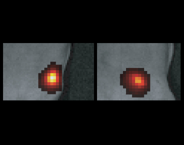 Image - Light emitted by nanoparticles injected into the mammary fat pads of a live mouse is imaged through several millimeters of tissue. This sequence shows how the light emitted by these laser-excited particles can be imaged through deep tissue two hours after injection (left), four hours after injection (center), and six hours after injection (right). (Credit: UC San Francisco)