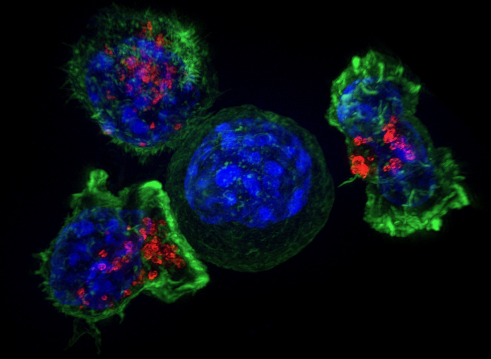 Killer T cells surround a cancer cell. Killer T cells are a type of immune cells that detect and remove unhealthy cells, including cancer cells and virus-infected cells.