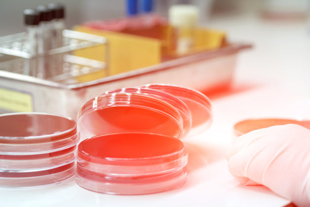 bacteria culture and antibacterial resistance