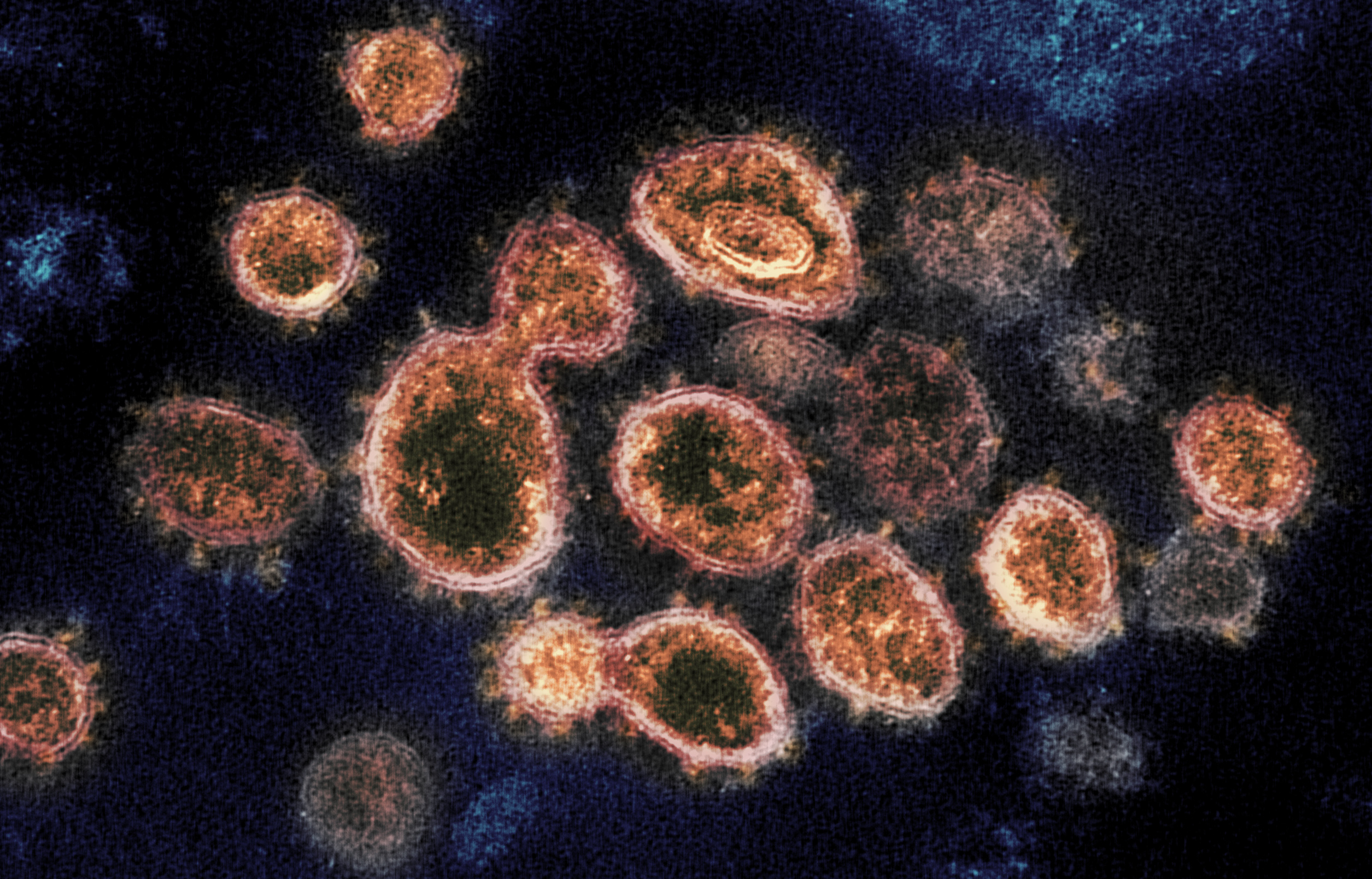This transmission electron microscope image shows SARS-CoV-2—also known as 2019-nCoV, the virus that causes COVID-19—isolated from a patient in the U.S.