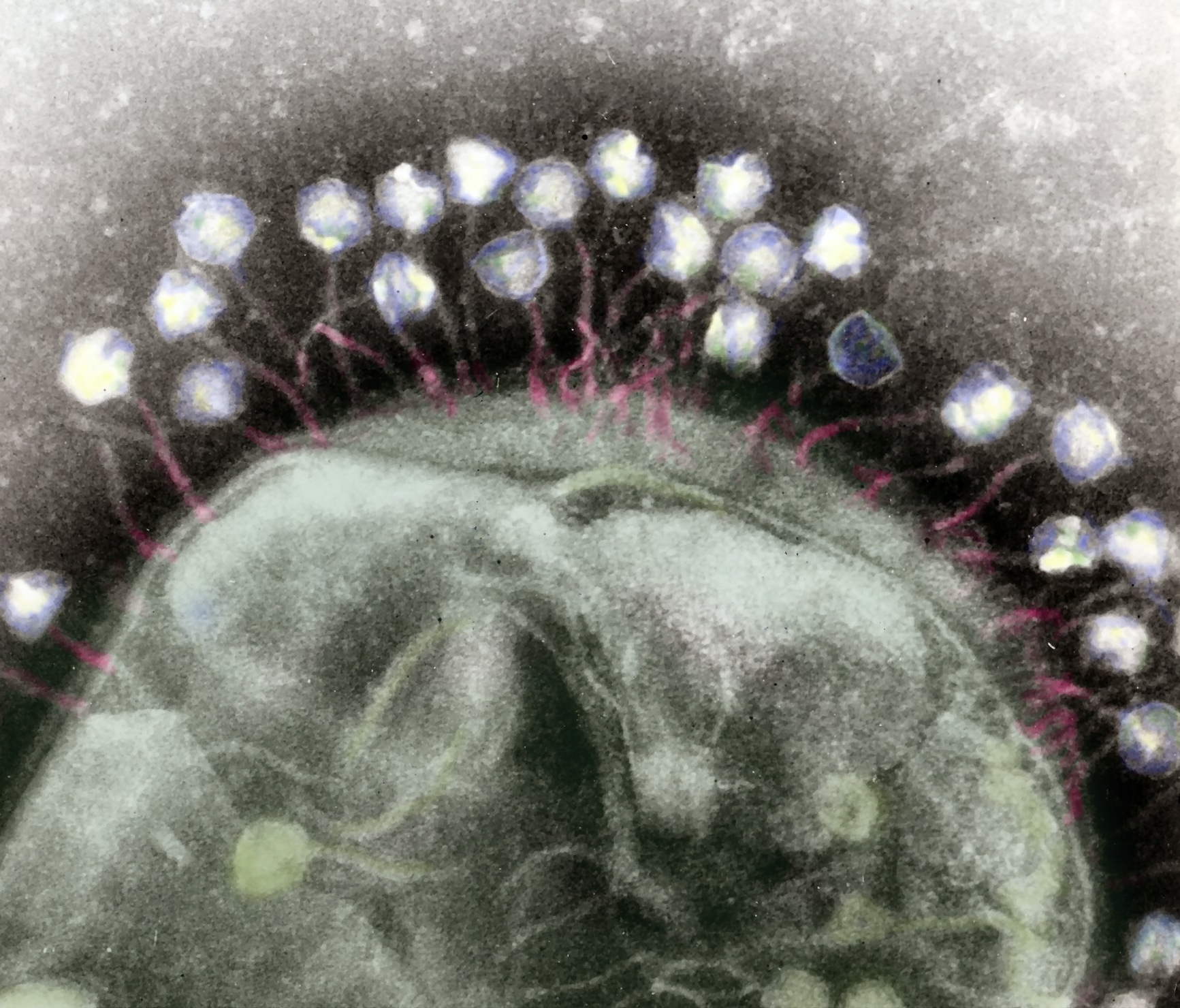 A microscopy image of phages attacking a bacterium