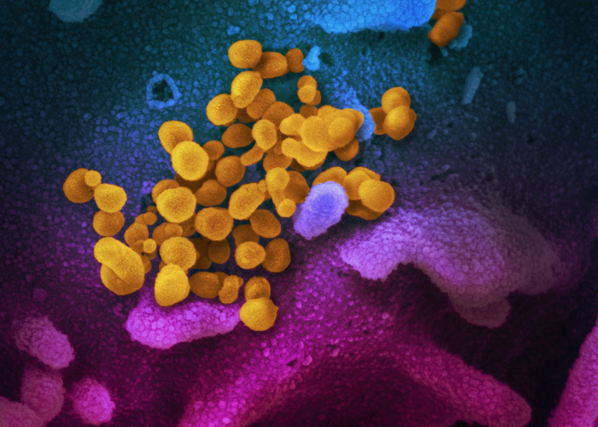 Microscopy image of the SARS-CoV-2 virus