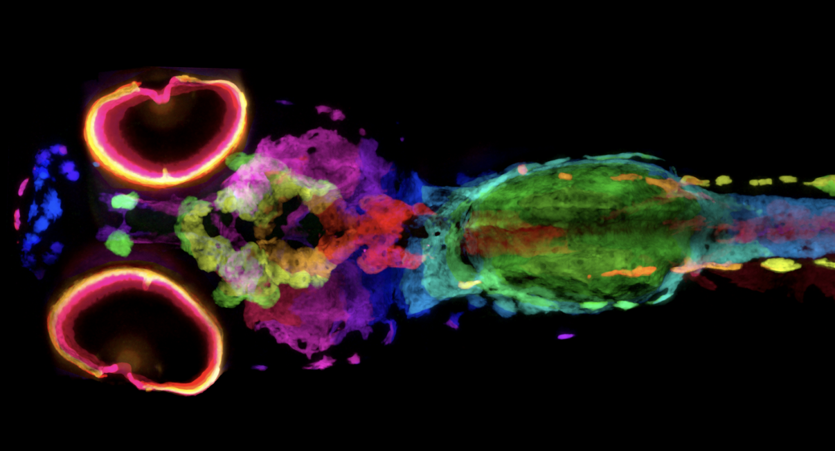 3D image of melanin in a zebrafish sample captured by micro-computed tomography. (Credit: Spencer R. Katz and Daniel J. Vanselow/Penn State College of Medicine)