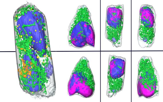 Seven illustrations of cells infected with SARS-CoV-2, created from soft X-ray tomography