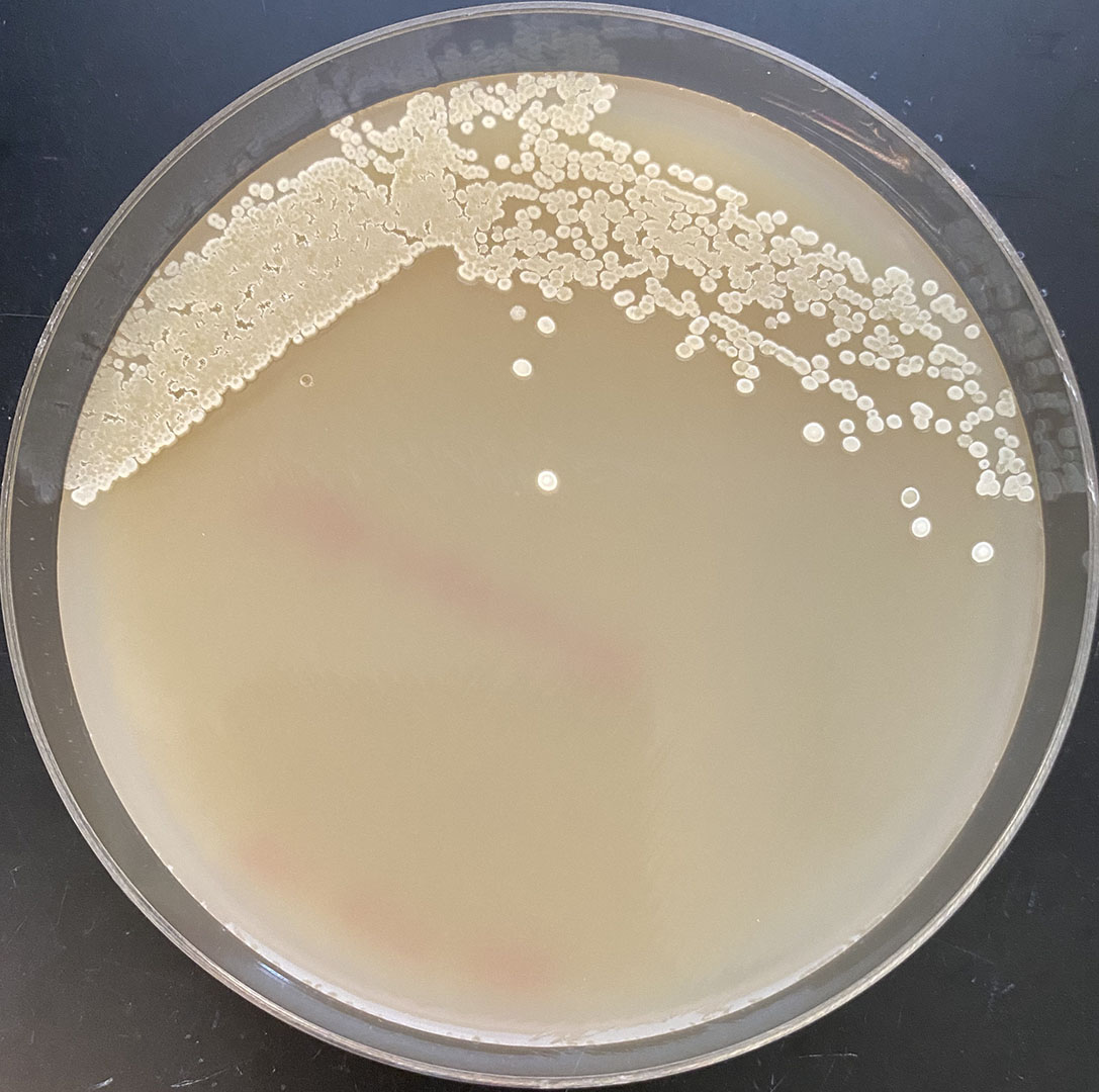 A petri dish of light brown substance/streptomytes.
