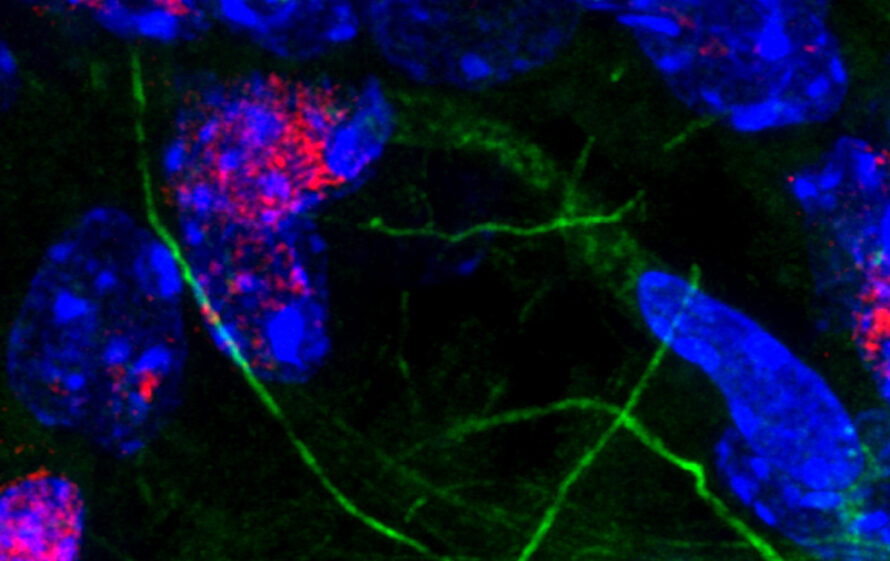 Immunofluorescent staining of mouse brain, showing neurons and glial cells in the hippocampus. Blue are cell nuclei, while green are microfilaments of the cell extensions, red is a marker of DNA damage and is predominantly in the neurons.