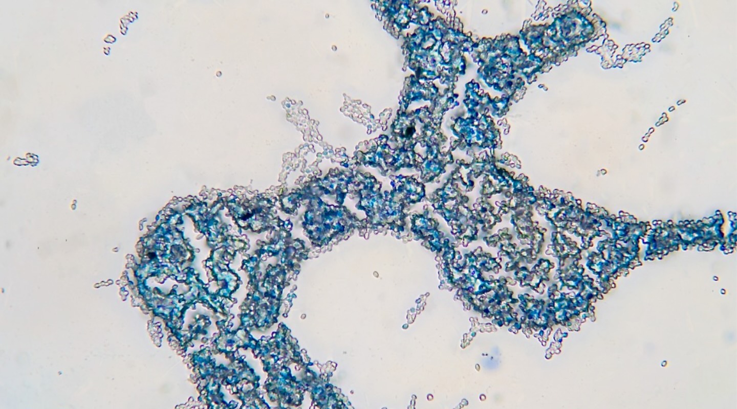 A microscopy slide showing a serpentine arrangement of membrane clusters that appear blue in color.