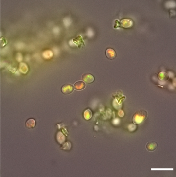 A few dozen cells with a simple oblong shape are imaged on a gray field. The cells appear green and red due to fluorescing proteins bound to elements that the cells have pulled from the urine.