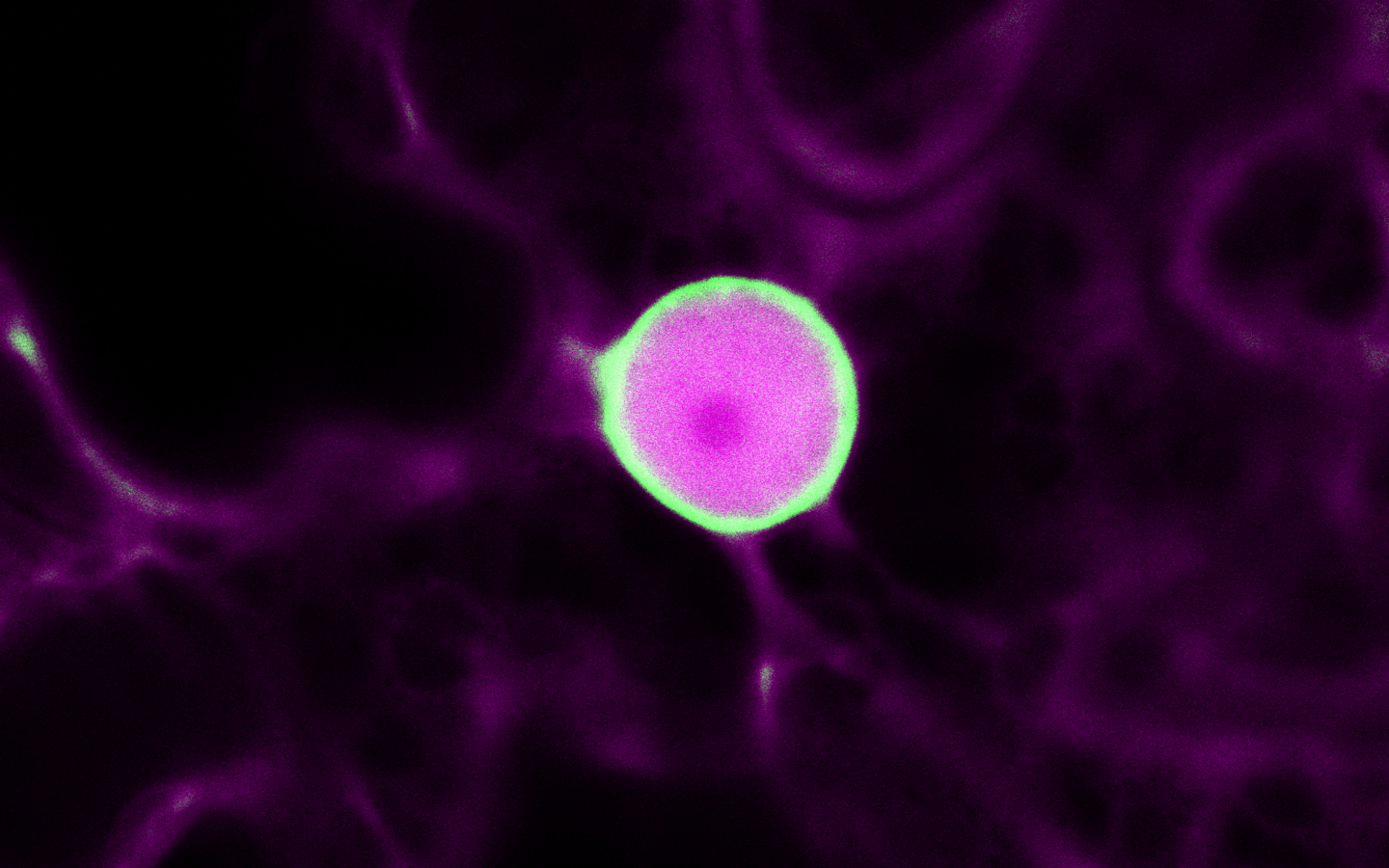 An irregular circle with a green rim and splotchy pink interior on a black background with faint magenta shapes.