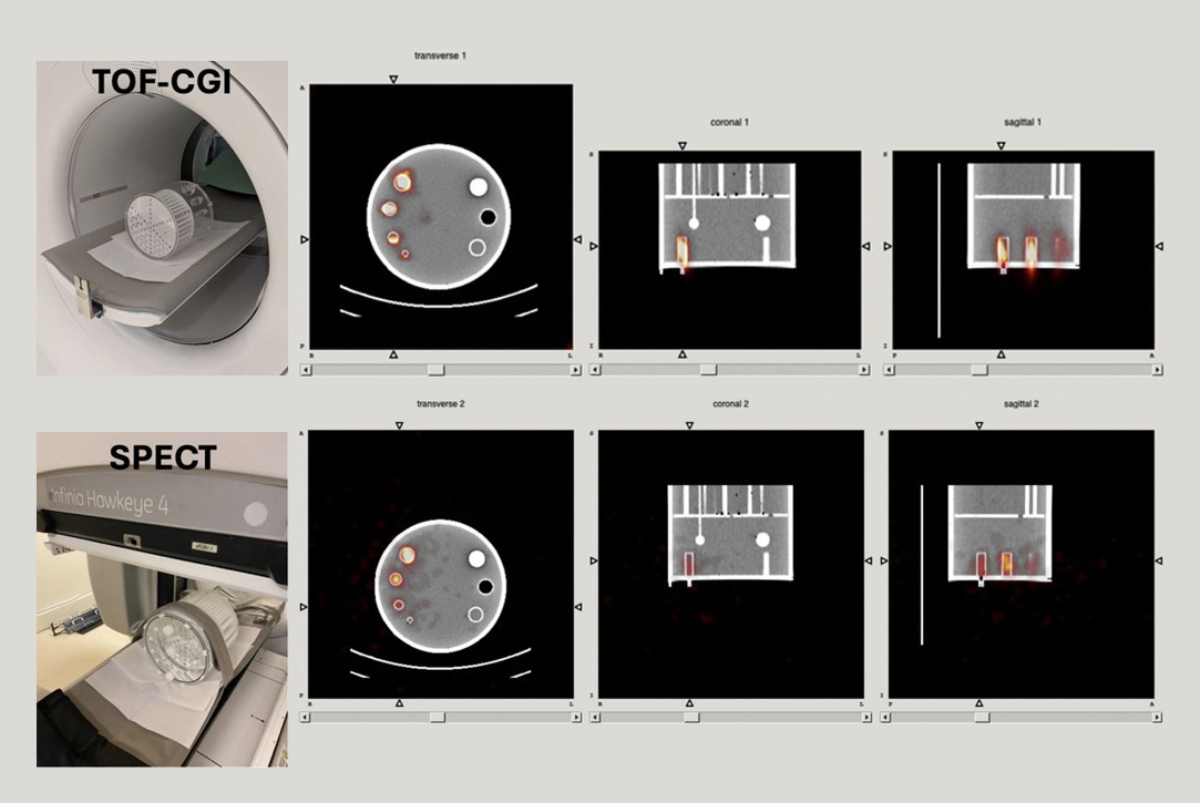 Side-by-side comparison of TOF-CGI image in a SIEMENS Vision scanner vs a SPECT image in a GE Hawkeye 4. The TOF-CGI images show much lower noise, which is reflected in superior SNR with respect to SPECT.