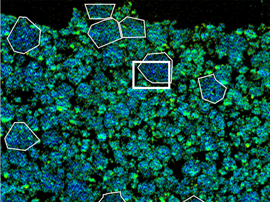 Densely packed green and blue cluster 2D shapes appear on a black background, with certain sections highlighted in white frames. The reference scale shows these clusters are less than 10 micrometers (millionths of a meter).