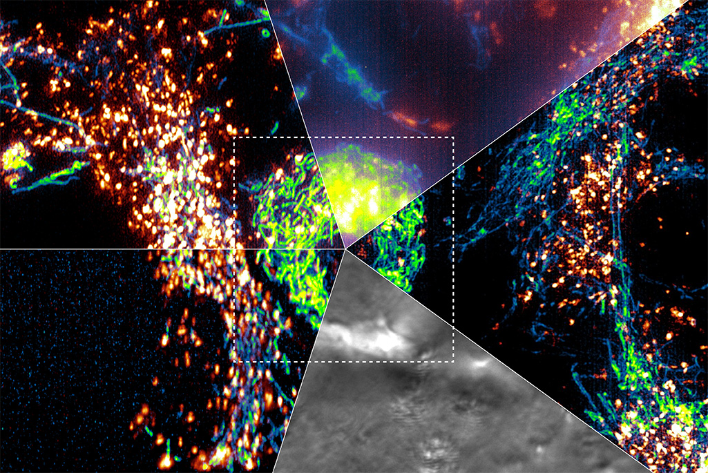 A composite microscopy image divided into five pinwheel-like triangular segments, each showing the same cellular structure using a different imaging technique. Glowing green, blue, orange, and grayscale patterns reveal varied subcellular details, with a dashed square highlighting a central area of interest.