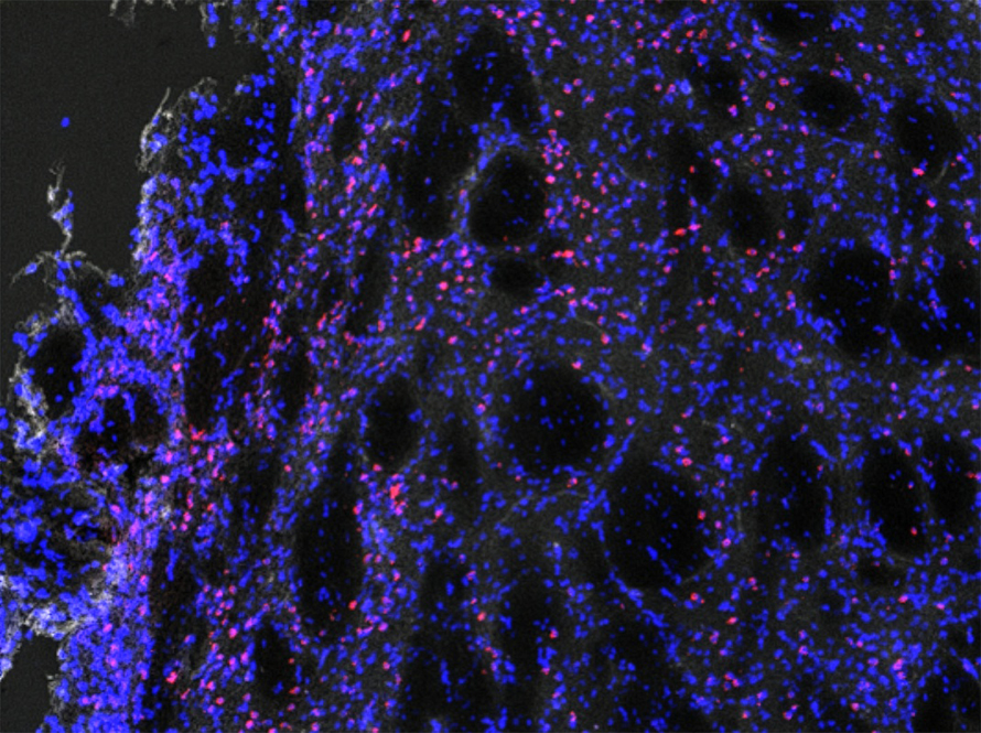 Microscopy image of brain tissue with many blue-stained cells and scattered pink dots, arranged around dark oval gaps.
