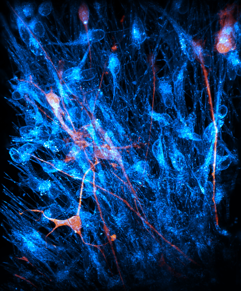 Blue and orange stained cells against a black background.
