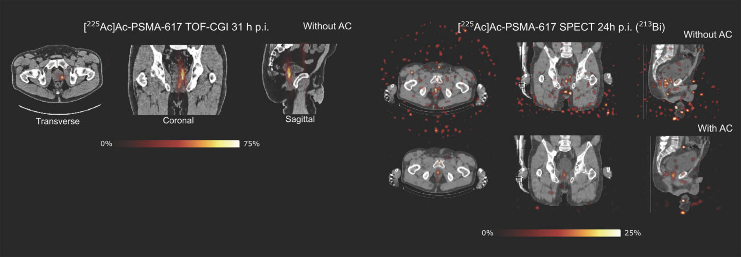 Black and white images of a human pelvis.