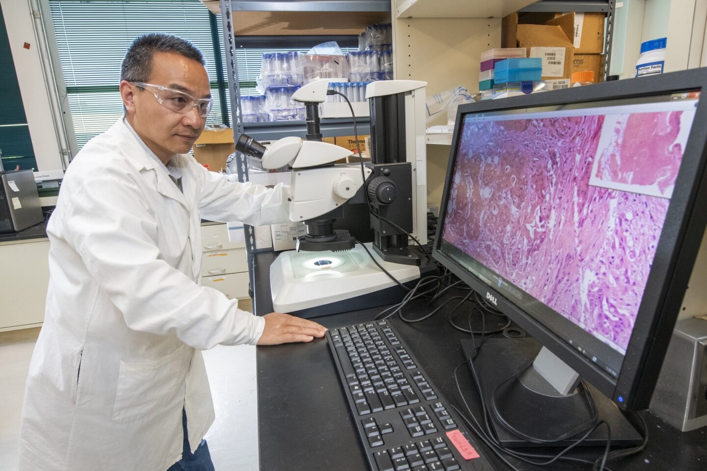A man in a white lab coat and safety glasses stands next to a microscope, the display from which is on a large computer monitor. The screen shows a sample of tissue stained reddish purple.