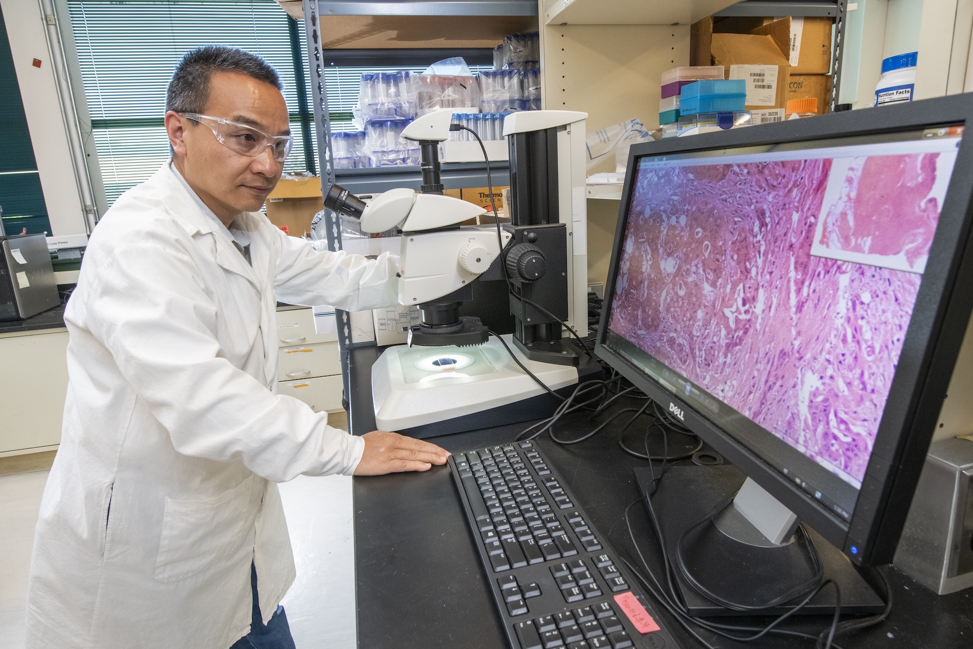 A Simple Blood Test Could Reveal Hidden Radiation Exposure